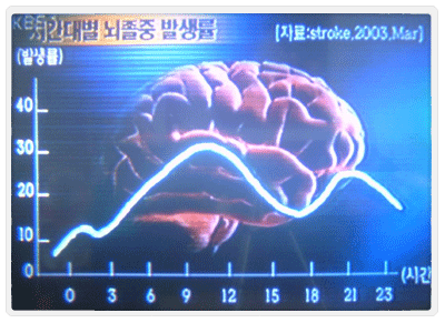 뇌졸중사망자수